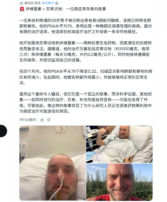 4期前列腺癌利物浦