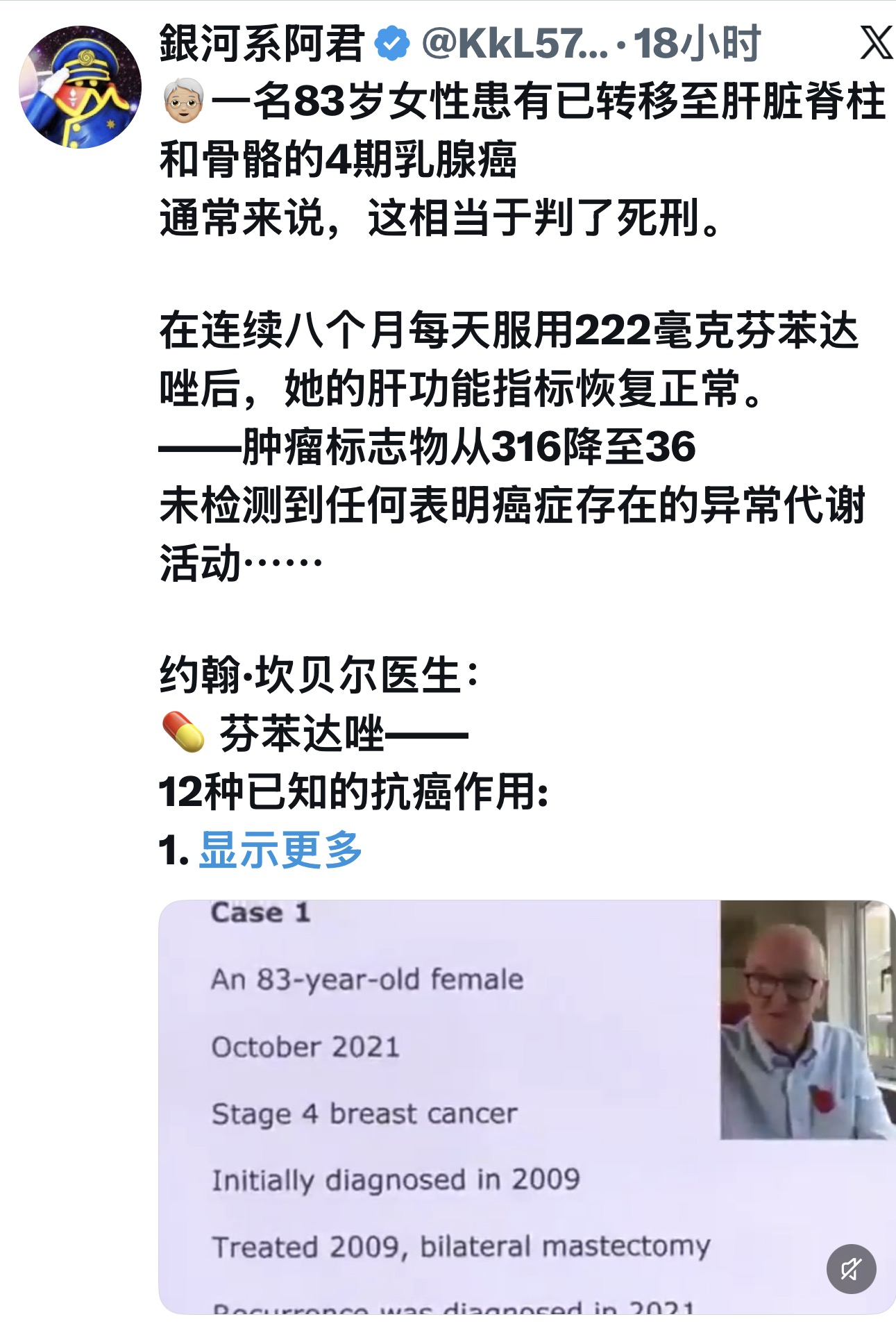 四期乳腺癌转移肝脏脊椎骨骼 8个月康复